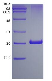 Recombinant Human 4-1BB Receptor/TNFRSF9